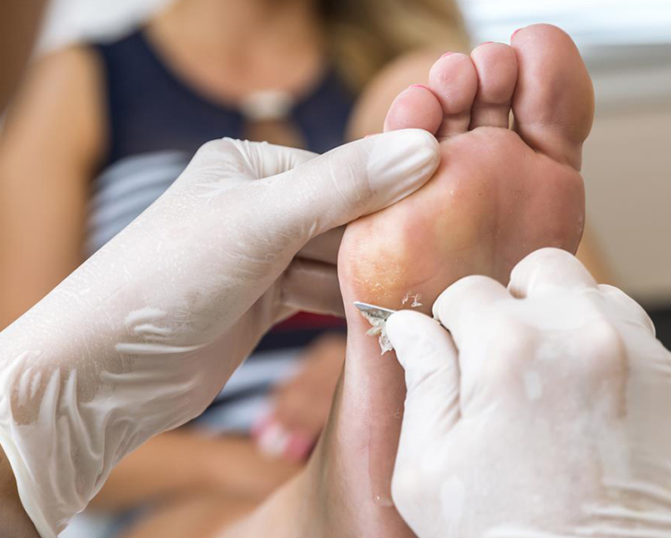Pedicure con Removedor de Callos