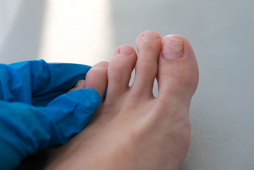 Pedicure con Reconstrucción